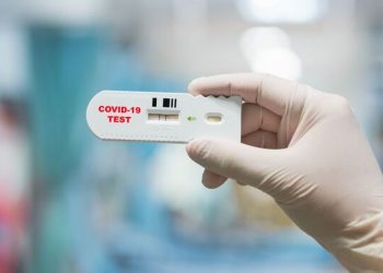 Gabon: le test Covid-19 payant pourrait faire son retour