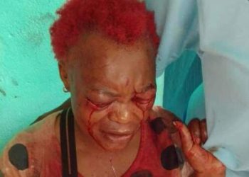 Un Camerounais crève les yeux de sa concubine et lui arrache l'oreille à l'aide d'un couteau
