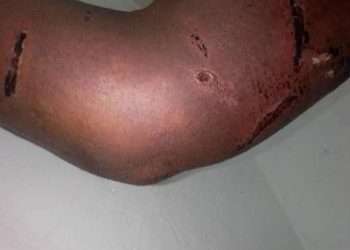 Acte de tortures à la prison centrale de Libreville sur un détenu